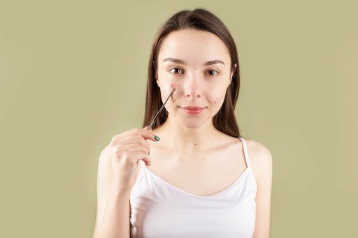 Comprehensive Guide to Big Pimple on Back Treatment: Outsmarting Acne for a Clearer Skin
